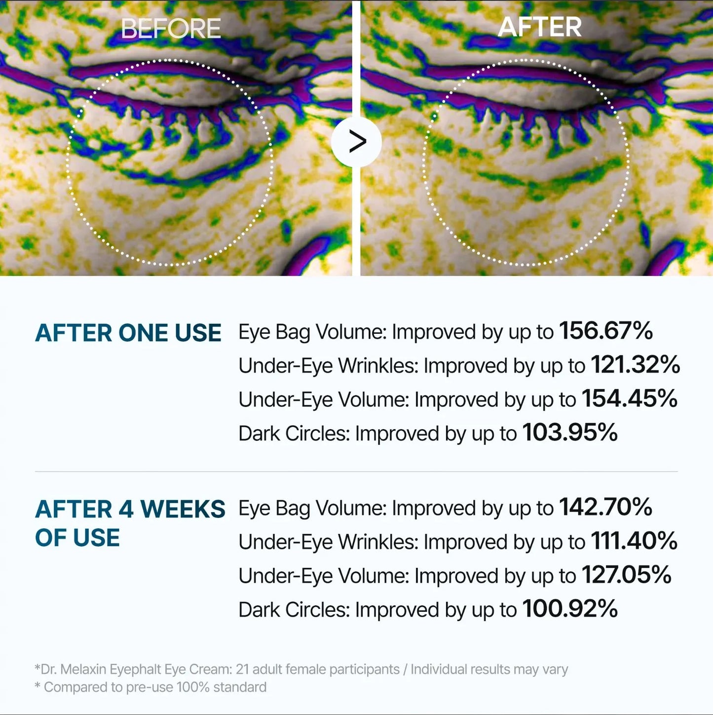 Melaxin Eyephalt Eyebag Cream ™