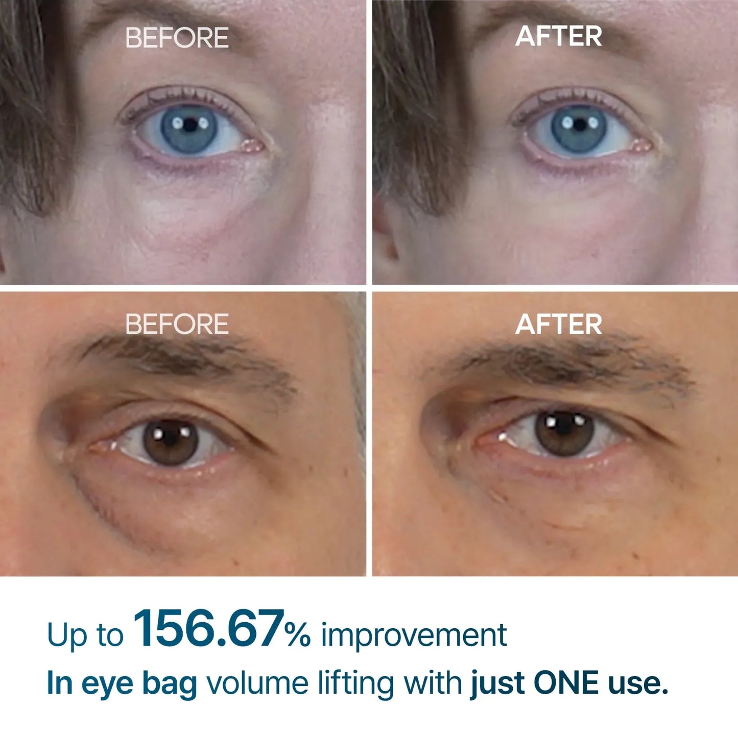 Melaxin Eyephalt Eyebag Cream ™