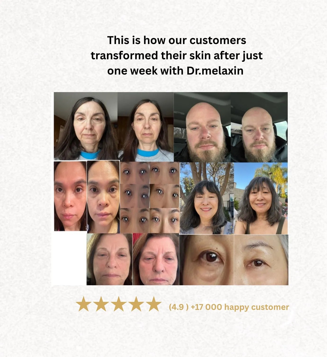 Melaxin Eyephalt Eyebag Cream ™