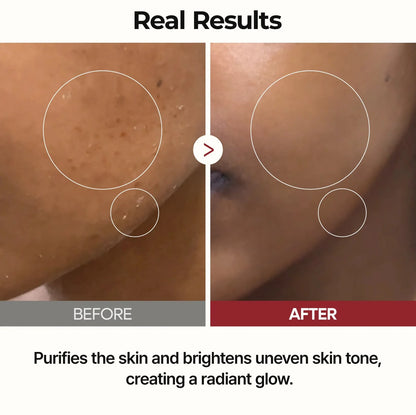 Peel Shot Glow Rice Toner ™