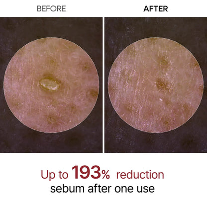Peel Shot Glow White Rice Ampoule ™