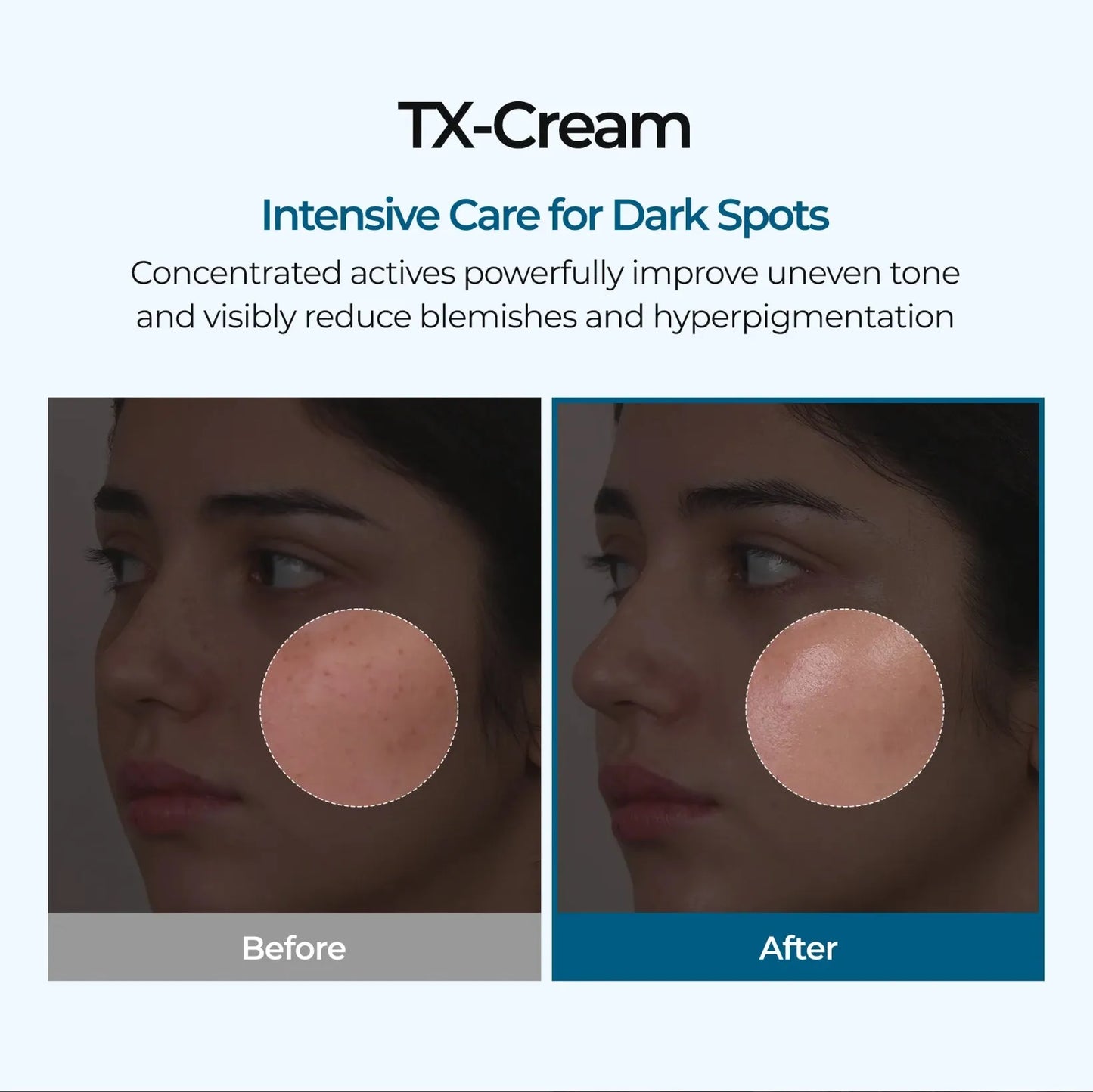 Melaxin TX       Cream ™
