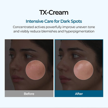 Melaxin TX       Cream ™