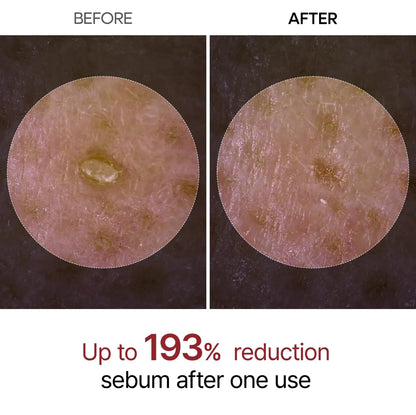 Peel Shot Glow Black Rice Ampoule ™
