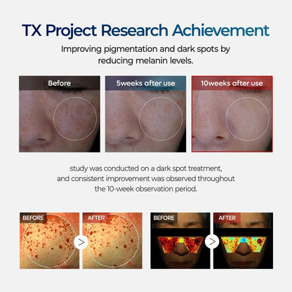 Melaxin TX       Cream ™